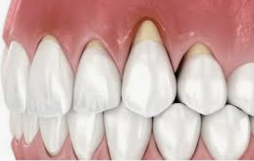 Periodontics & Gum Care