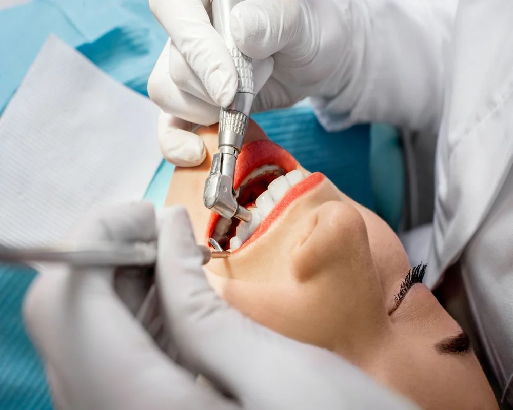 Dental hygienist performing a professional cleaning at MiNa Family Dentistry in Thornhill