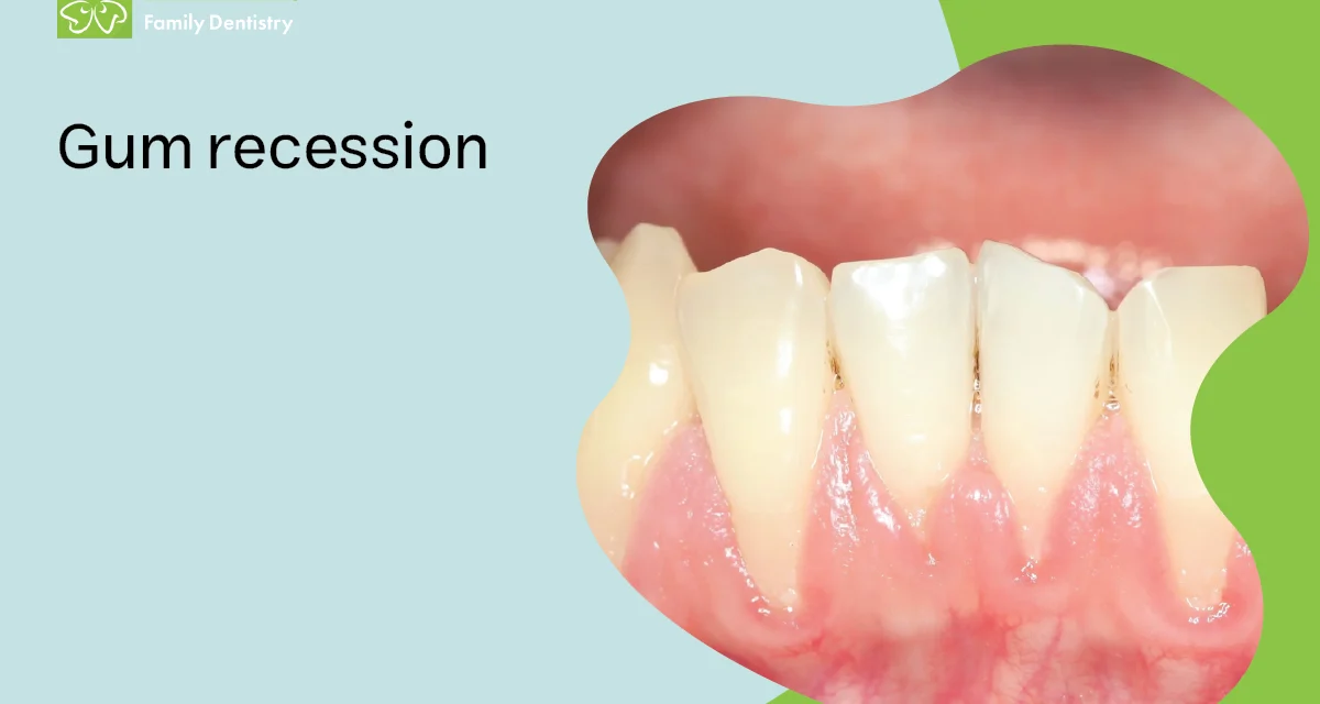 Gum Recession