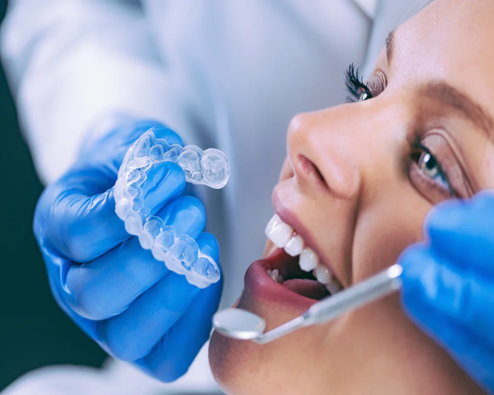 Invisalign clear aligner treatment at MiNa Family Dentistry, Thornhill