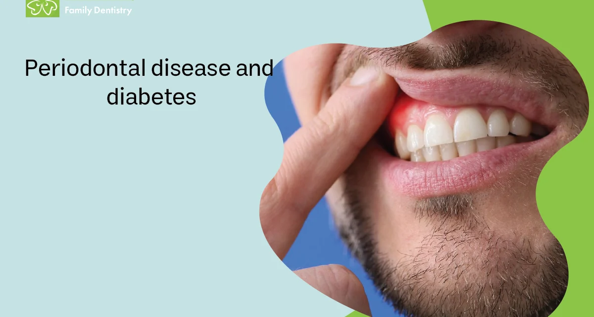 Periodontal Disease and Diabetes