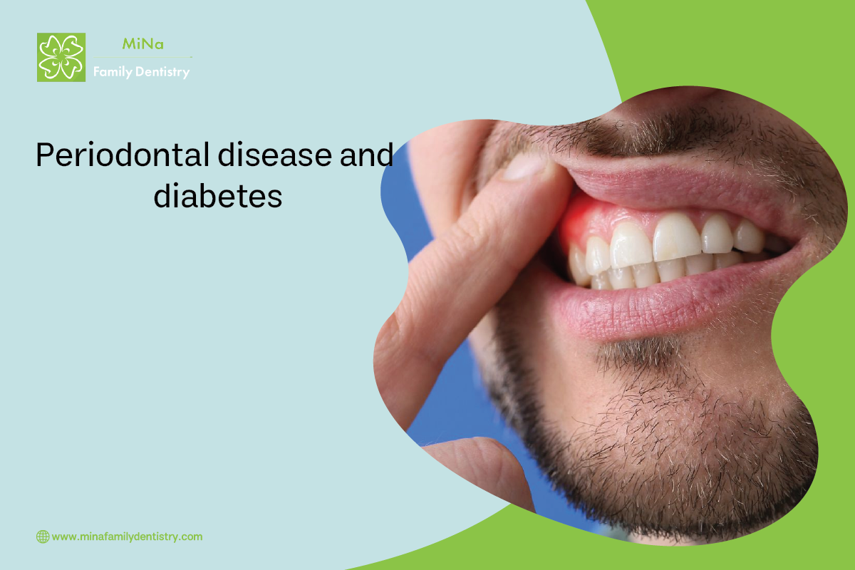The connection between periodontal disease and diabetes — MiNa Family Dentistry Thornhill