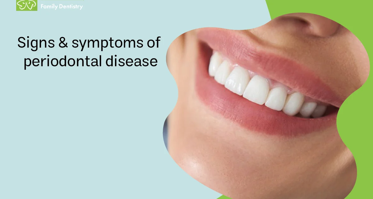 Signs & Symptoms of Periodontal Disease