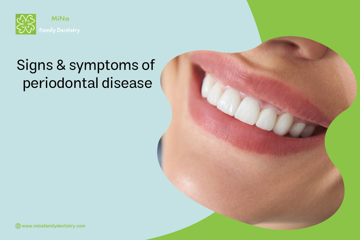 Common signs and symptoms of periodontal gum disease to watch for