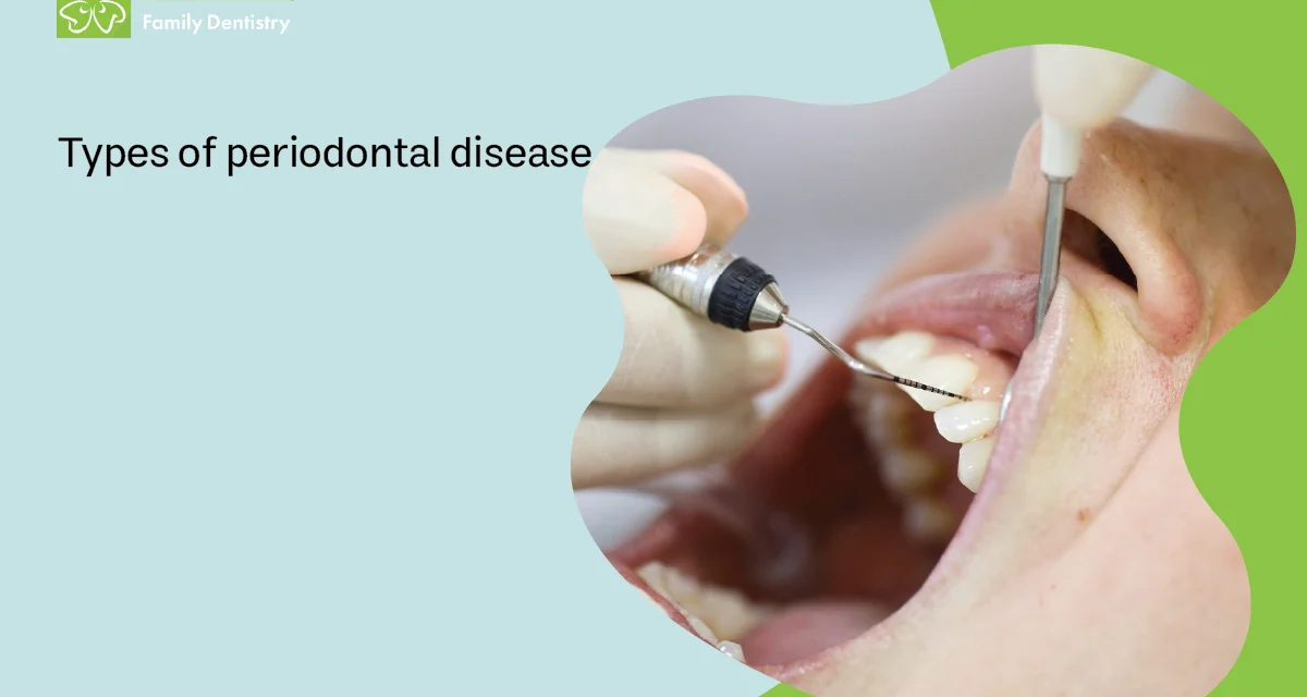Types of Periodontal Disease