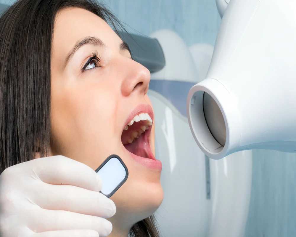 Digital dental X-ray imaging used at MiNa Family Dentistry in Thornhill