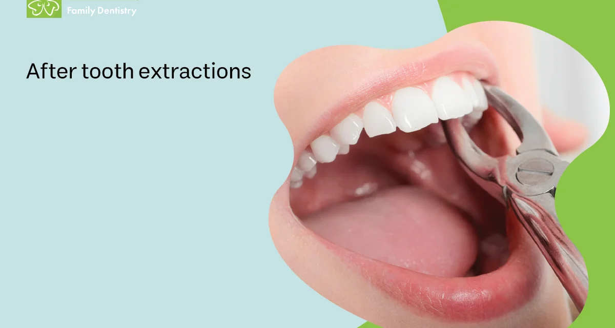 After Tooth Extractions