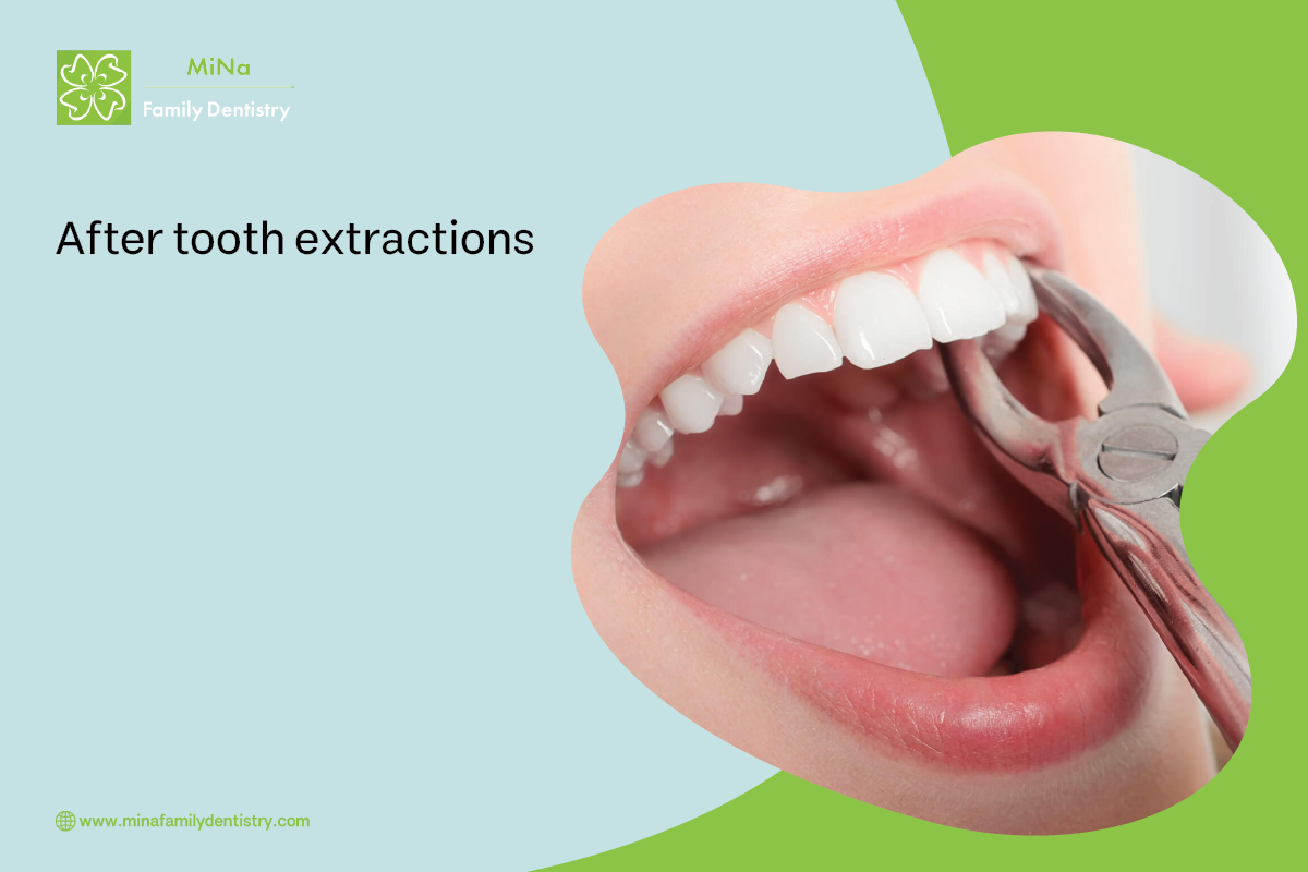 Tooth extraction aftercare instructions from MiNa Family Dentistry Thornhill