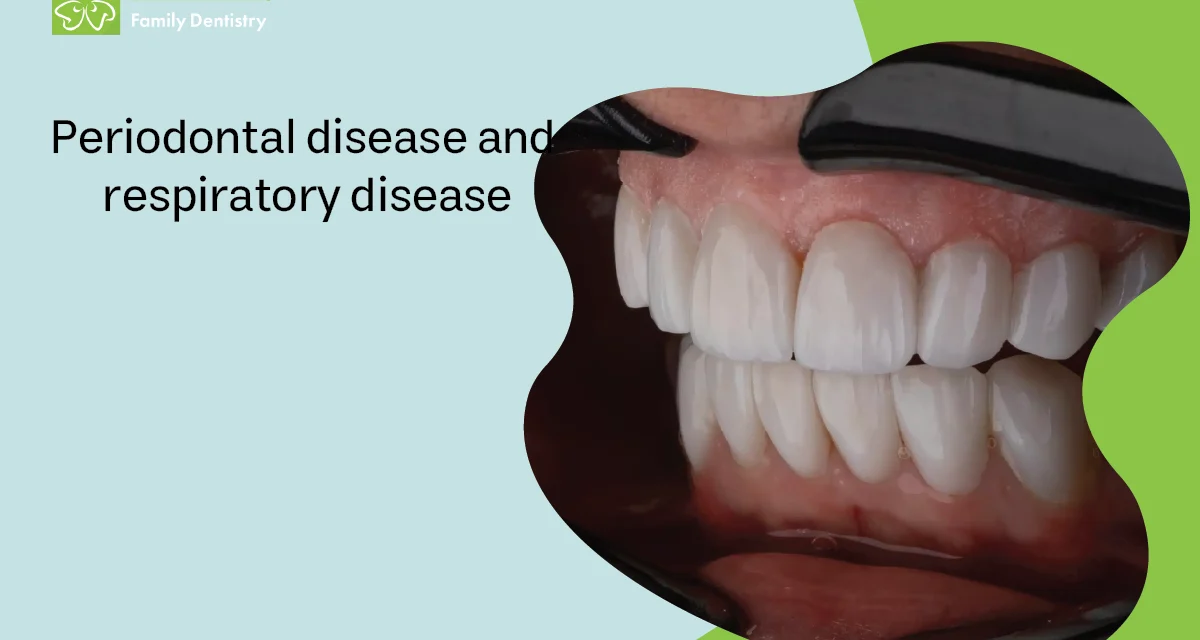 Periodontal Disease and Respiratory Disease
