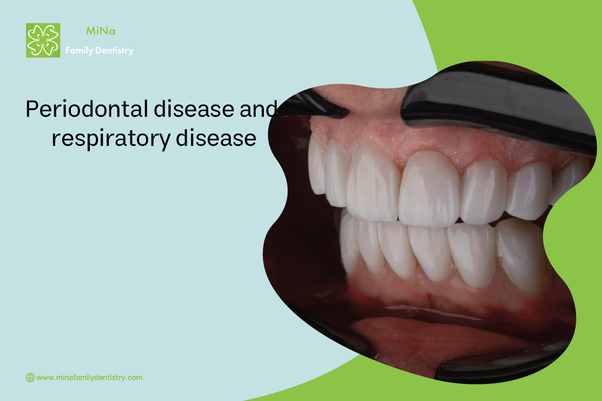 The link between periodontal disease and respiratory health conditions