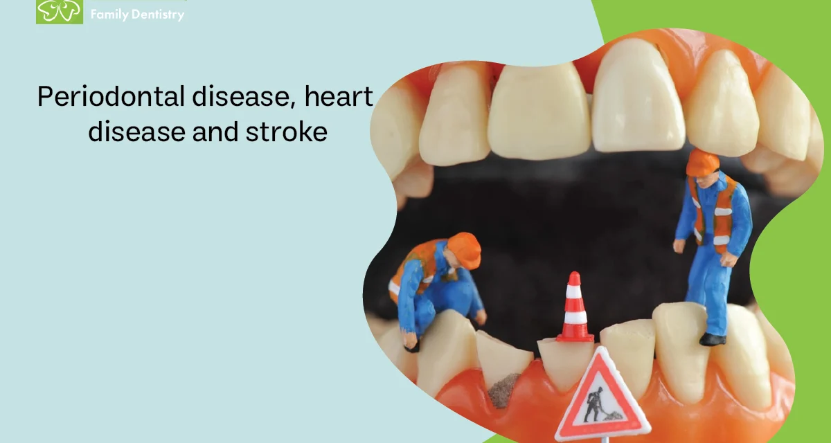 Periodontal Disease, Heart Disease and Stroke