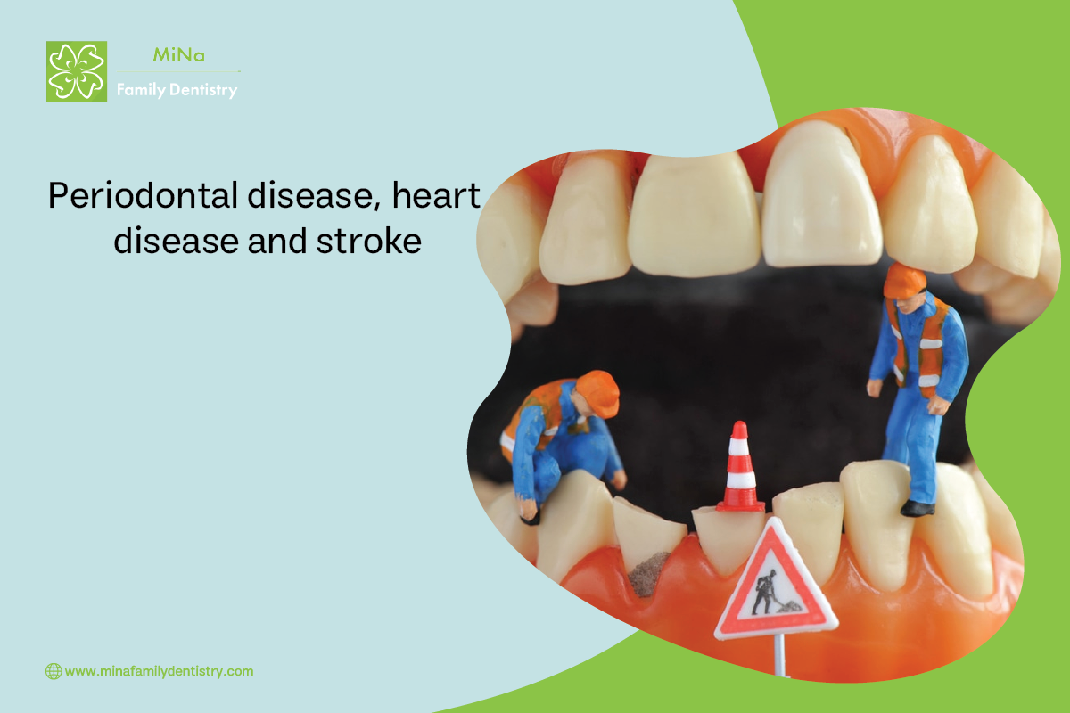 Link between periodontal disease and heart disease — systemic oral health connection