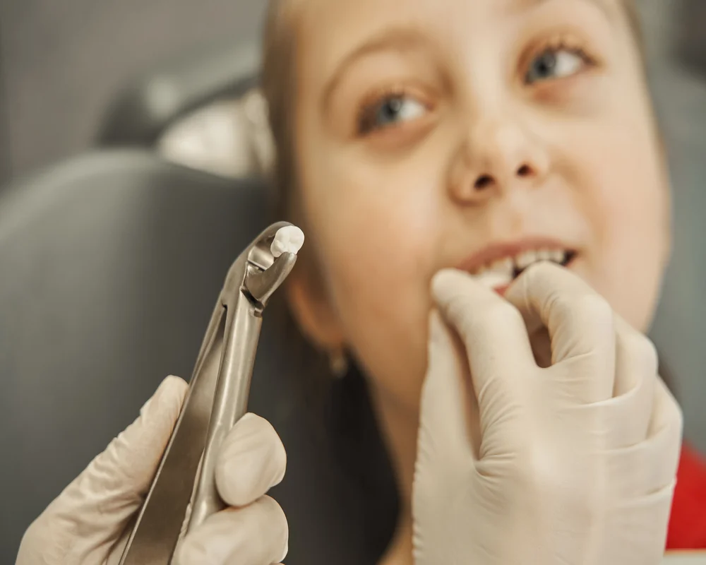 Wisdom Teeth Removal Thornhill: In-House Surgical Care With No Referral Required