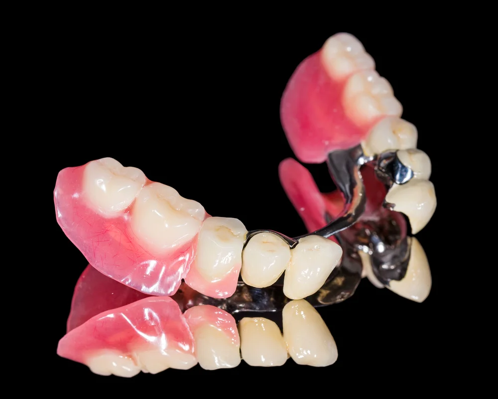 Dental Bridge Thornhill: Restore a Missing Tooth at MiNa Family Dentistry