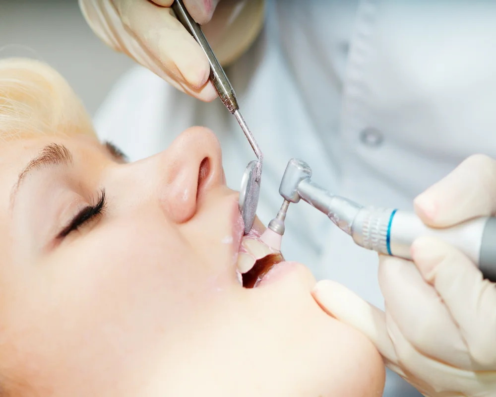 Professional Teeth Cleaning in Thornhill — What to Expect at Every Visit