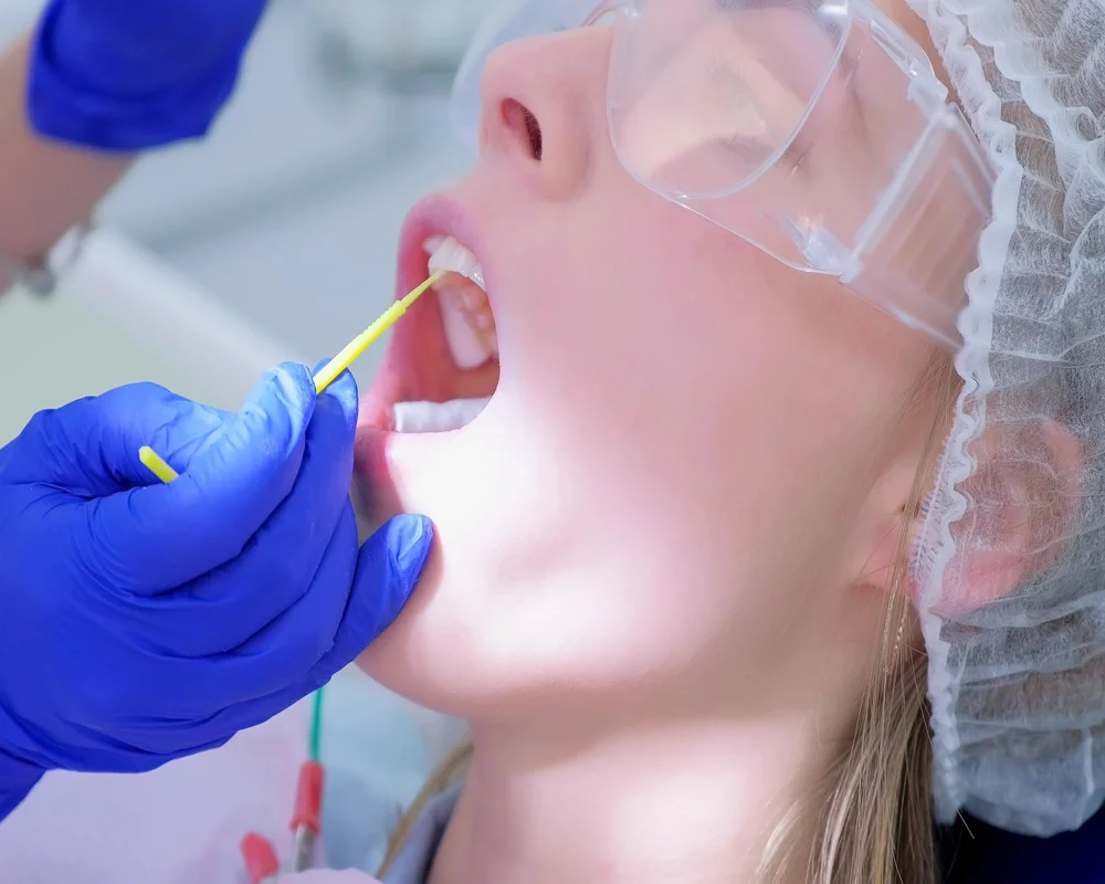 Child receiving professional fluoride varnish treatment at MiNa Family Dentistry, Thornhill
