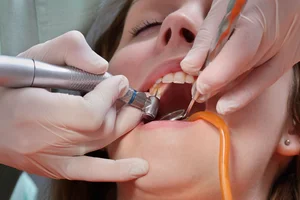 Endodontic and root canal treatment at MiNa Family Dentistry, Thornhill