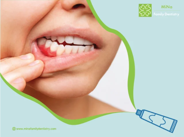 Healthy gums after periodontal care at MiNa Family Dentistry, Thornhill