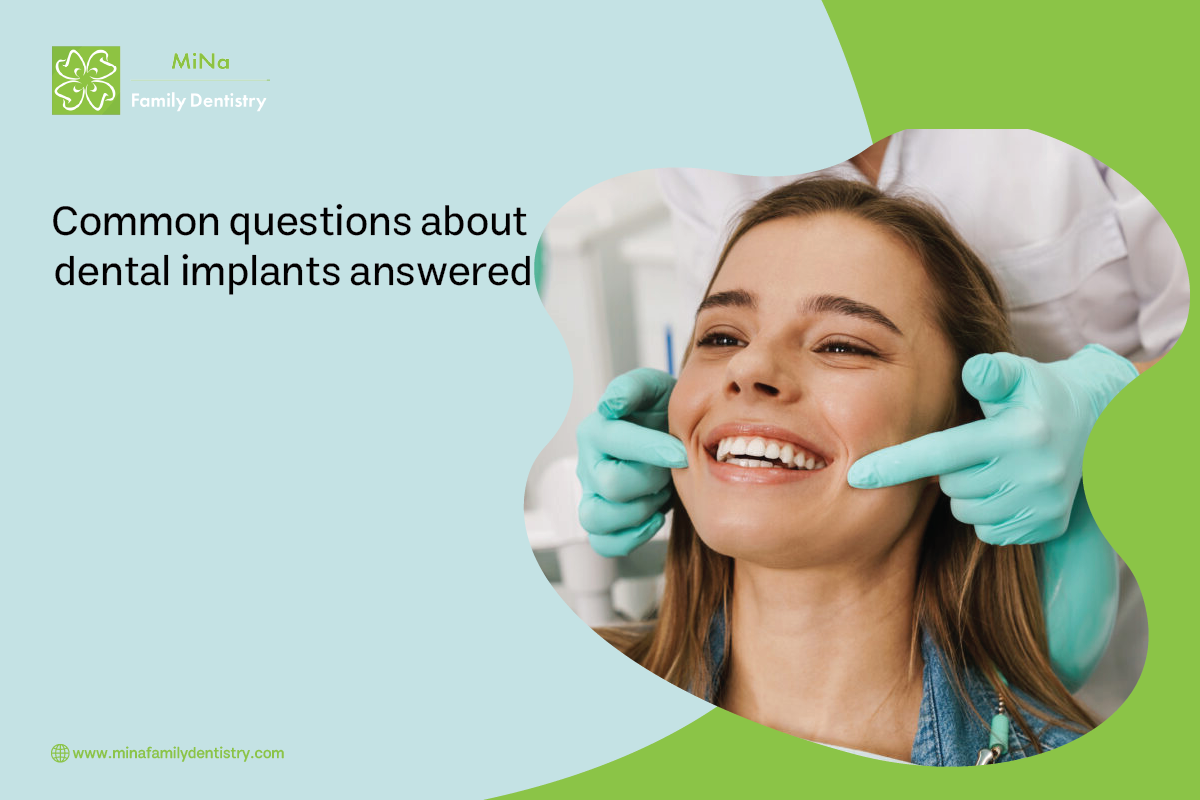Common Questions About Dental Implants Answered