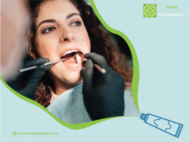 Composite filling result at MiNa Family Dentistry, Thornhill