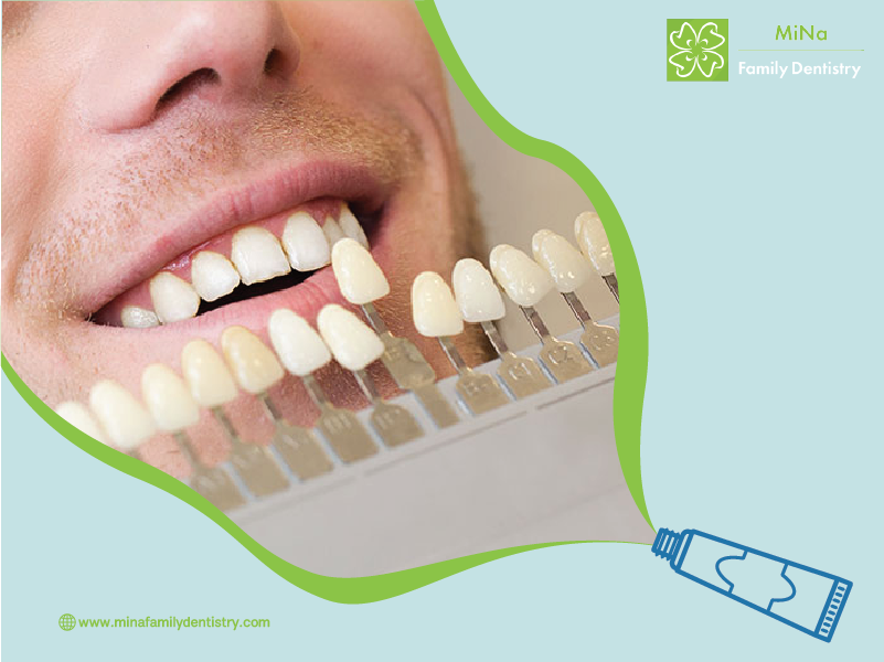 Dentist selecting the perfect veneer shade for a smile makeover patient at MiNa Family Dentistry