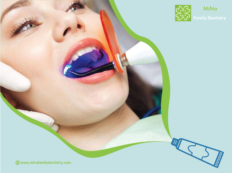 Cosmetic dental bonding and composite resin procedure being performed at MiNa Family Dentistry, Thornhill