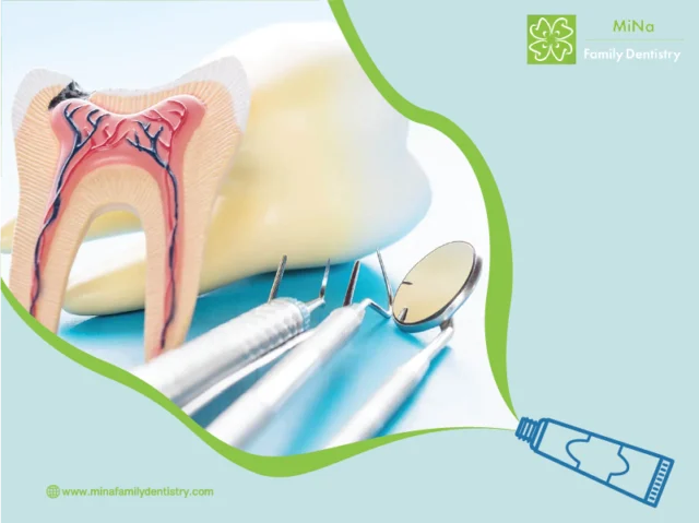 Root canal treatment at MiNa Family Dentistry, Thornhill