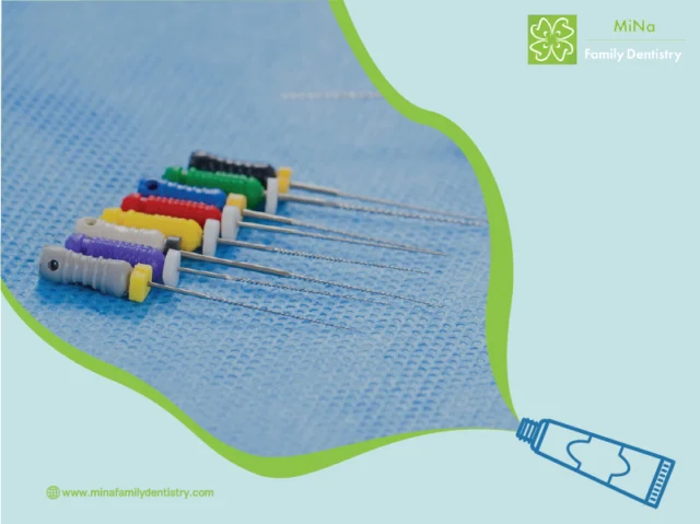 Root canal treatment outcome at MiNa Family Dentistry