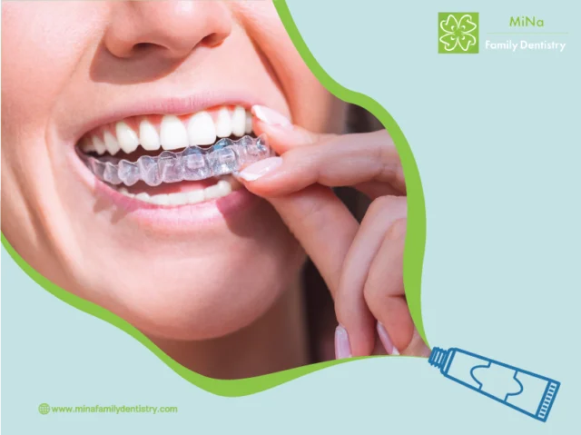 Invisalign result — before and after at MiNa Family Dentistry, Thornhill