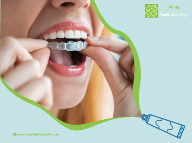 Invisalign patient result at MiNa Family Dentistry, Thornhill